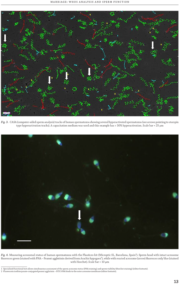 Fig. 4. Measuring acrosomal status